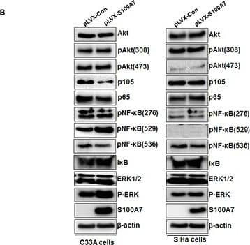 S100A7/Psoriasin Antibody (47C1068) - BSA Free