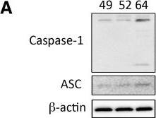 Caspase-1 Antibody (14F468) - BSA Free