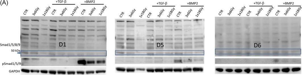SMAD1/5/8/9 Antibody - BSA Free