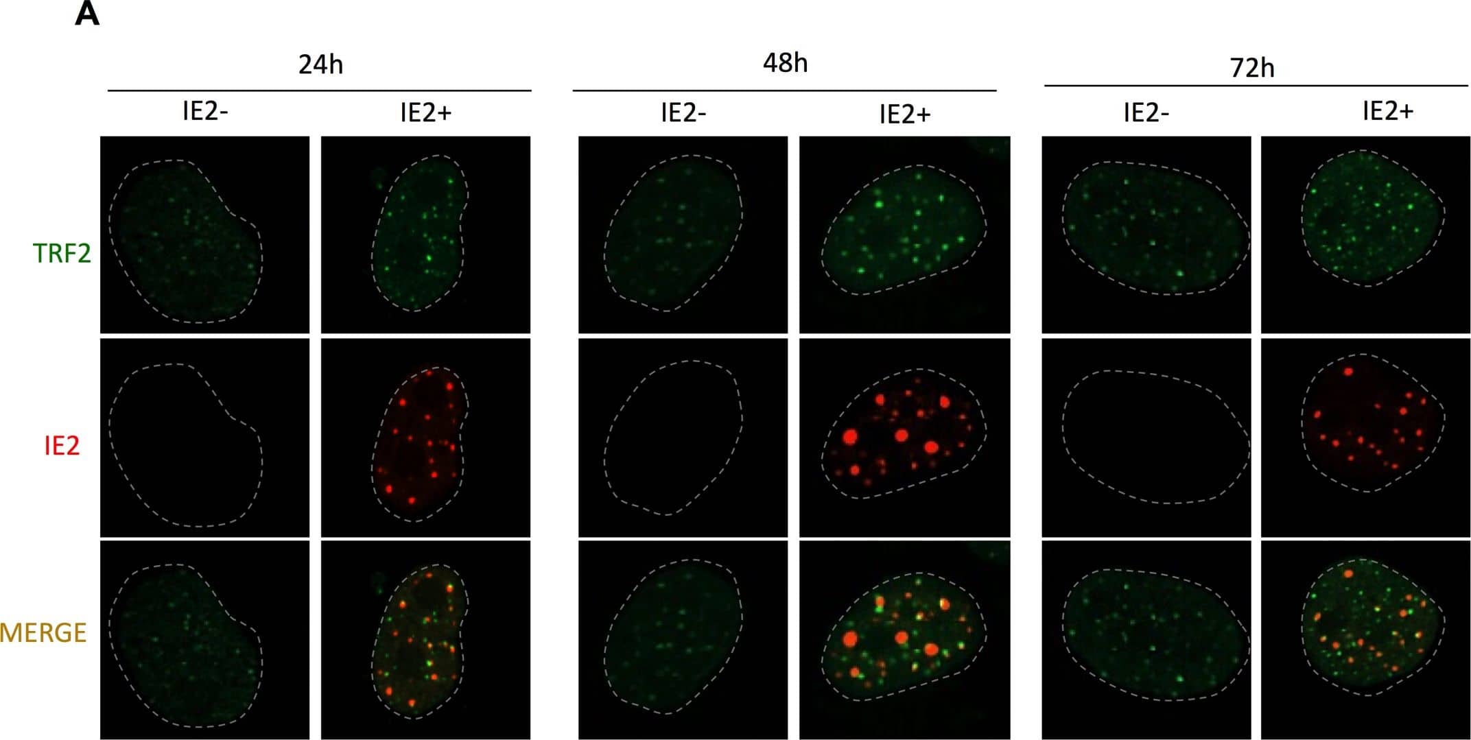 TRF-2 Antibody