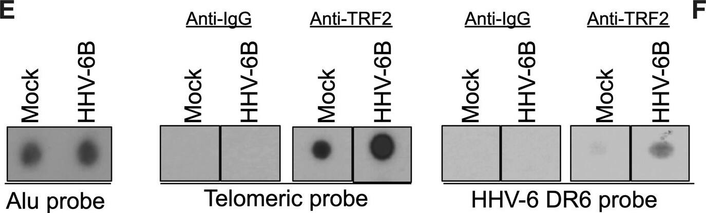 TRF-2 Antibody