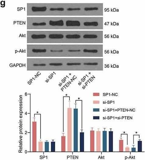 AKT1 [p Ser473] Antibody (104A282) - BSA Free