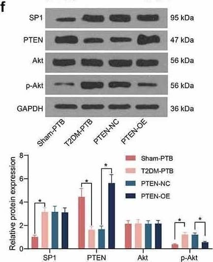 AKT1 [p Ser473] Antibody (104A282) - BSA Free