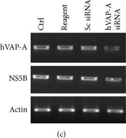 beta-Actin Antibody