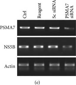 beta-Actin Antibody