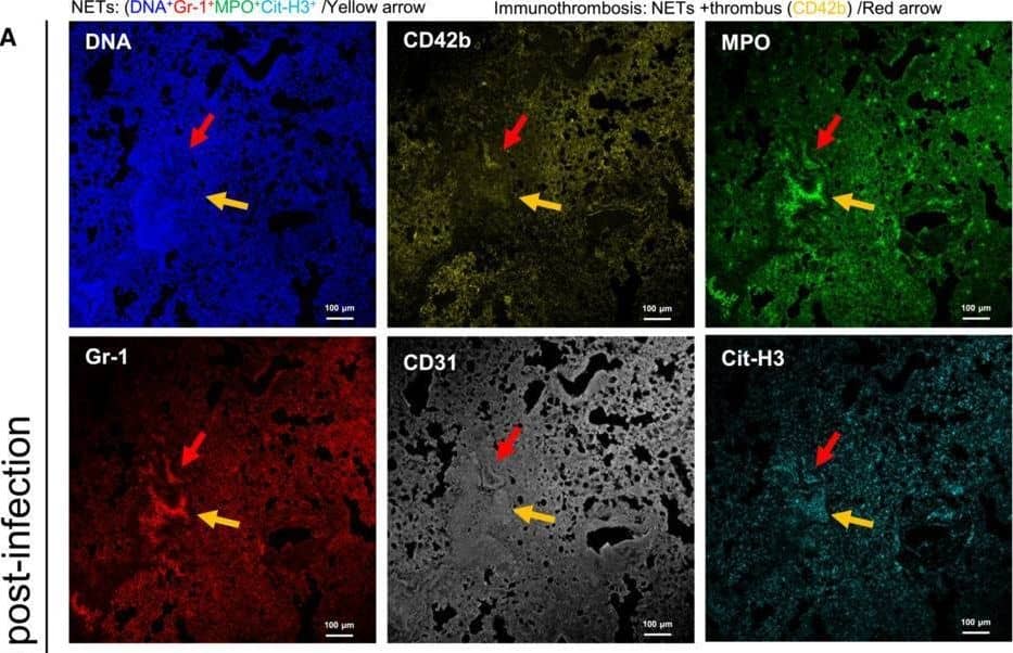Histone H3 [Citrulline Arg17, Citrulline Arg2, Citrulline Arg8] Antibody