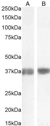 Arginase 1/ARG1/liver Arginase Antibody