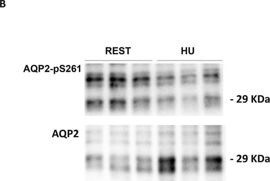 Aquaporin-2 [p Ser261] Antibody - Azide Free