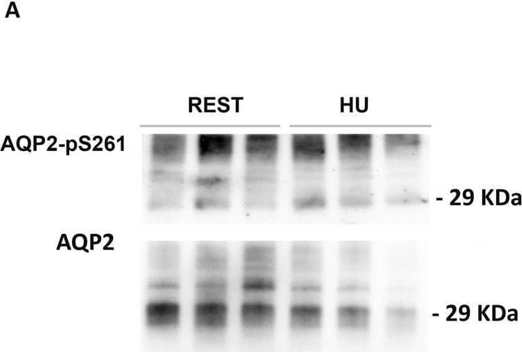 Aquaporin-2 [p Ser261] Antibody - Azide Free