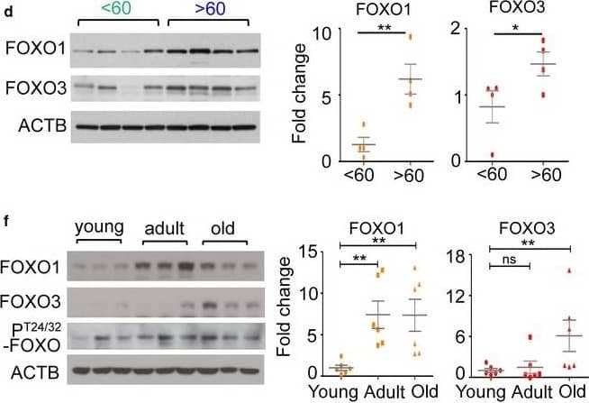 FOXO3 Antibody