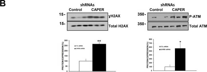 Histone H2AX Antibody - BSA Free (NB100-638) by Novus, Part Histone H2AX Antibody - BSA Free (NB100-638) by Novus, Part