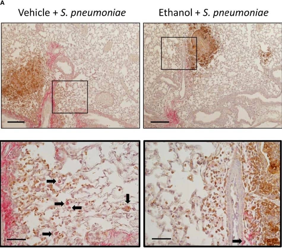 Streptococcus pneumoniae Antibody
