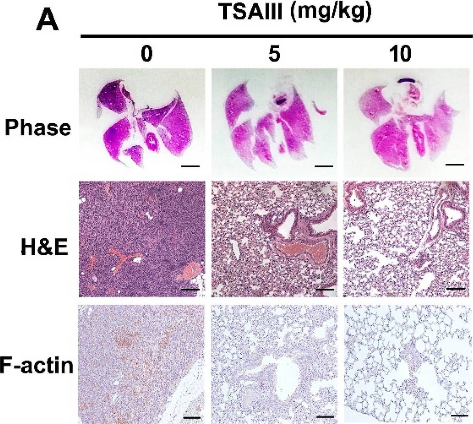 Actin Gamma 1 Antibody (NH3) - BSA Free