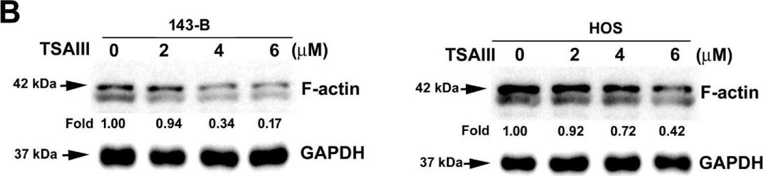 Actin Gamma 1 Antibody (NH3) - BSA Free