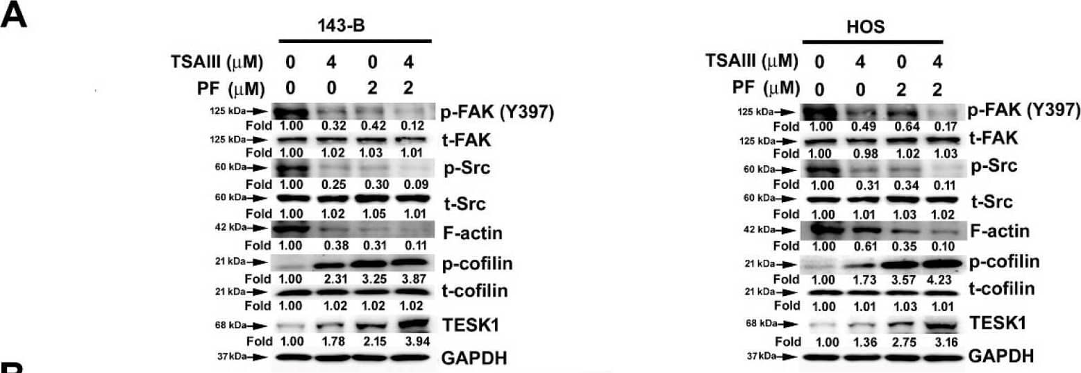 Actin Gamma 1 Antibody (NH3) - BSA Free