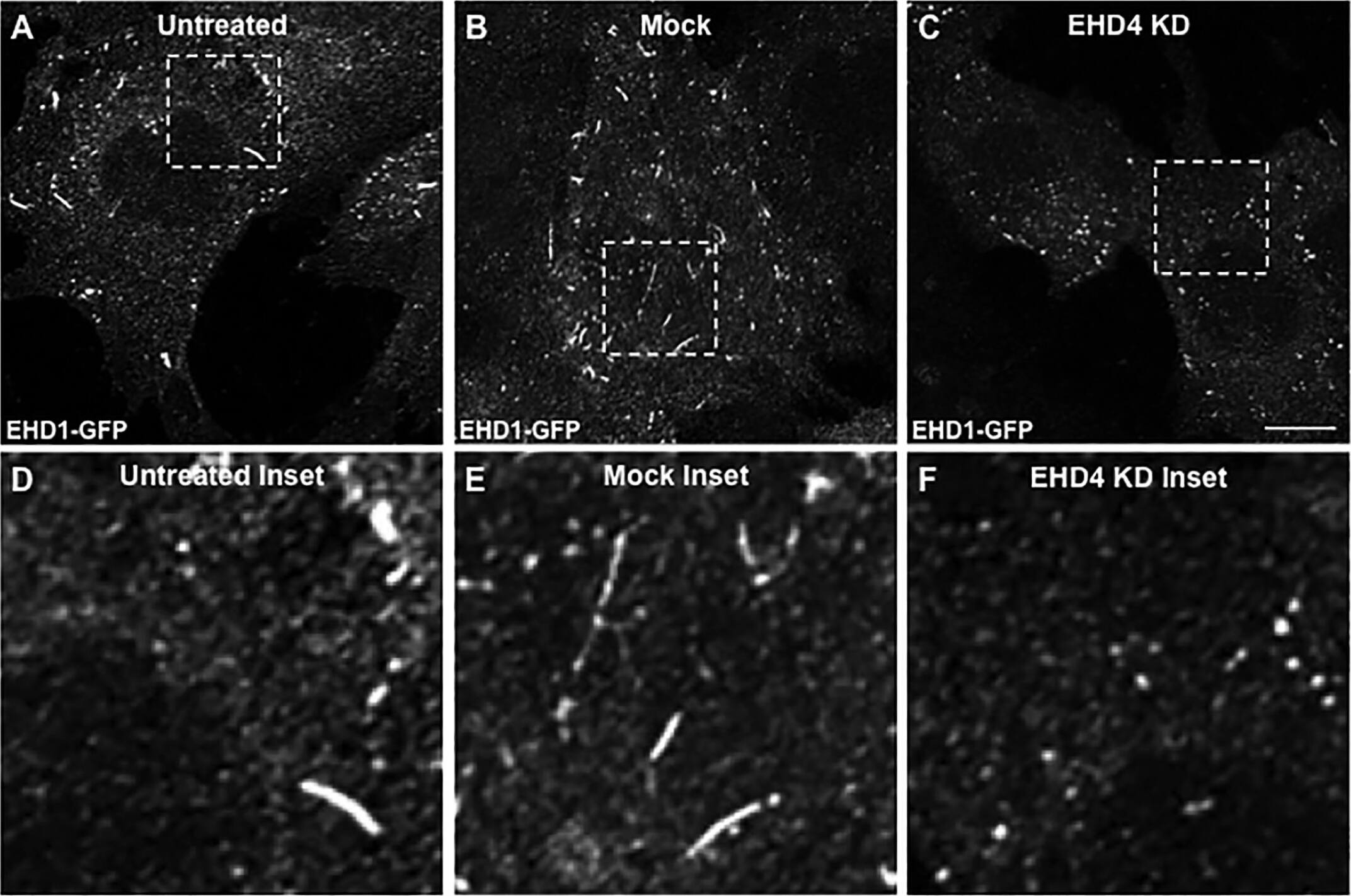 LRP-1 Antibody (A2Mr alpha-2)