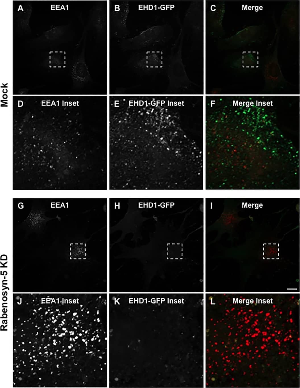 LRP-1 Antibody (A2Mr alpha-2)