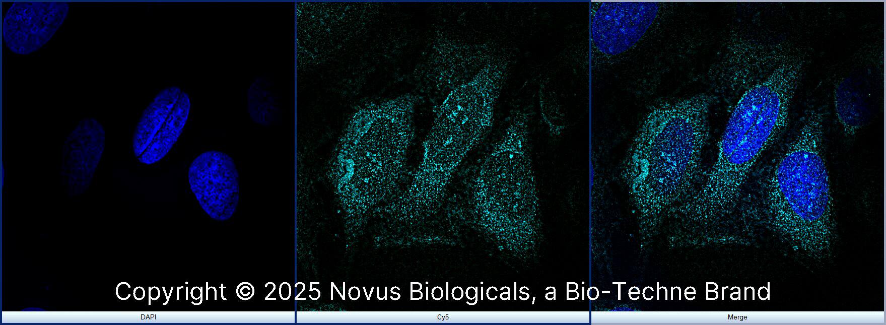 rRNA Antibody (Y10b) [Alexa Fluor® 647]