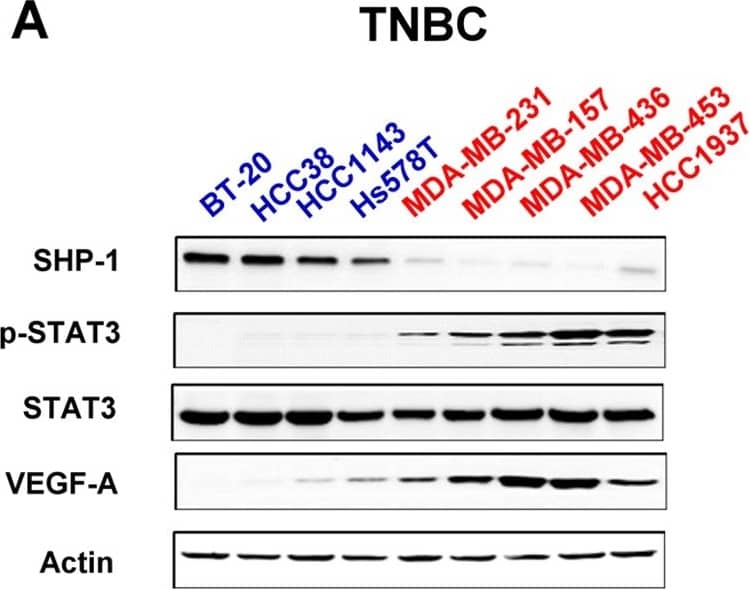 VEGF Antibody (VG1) - BSA Free