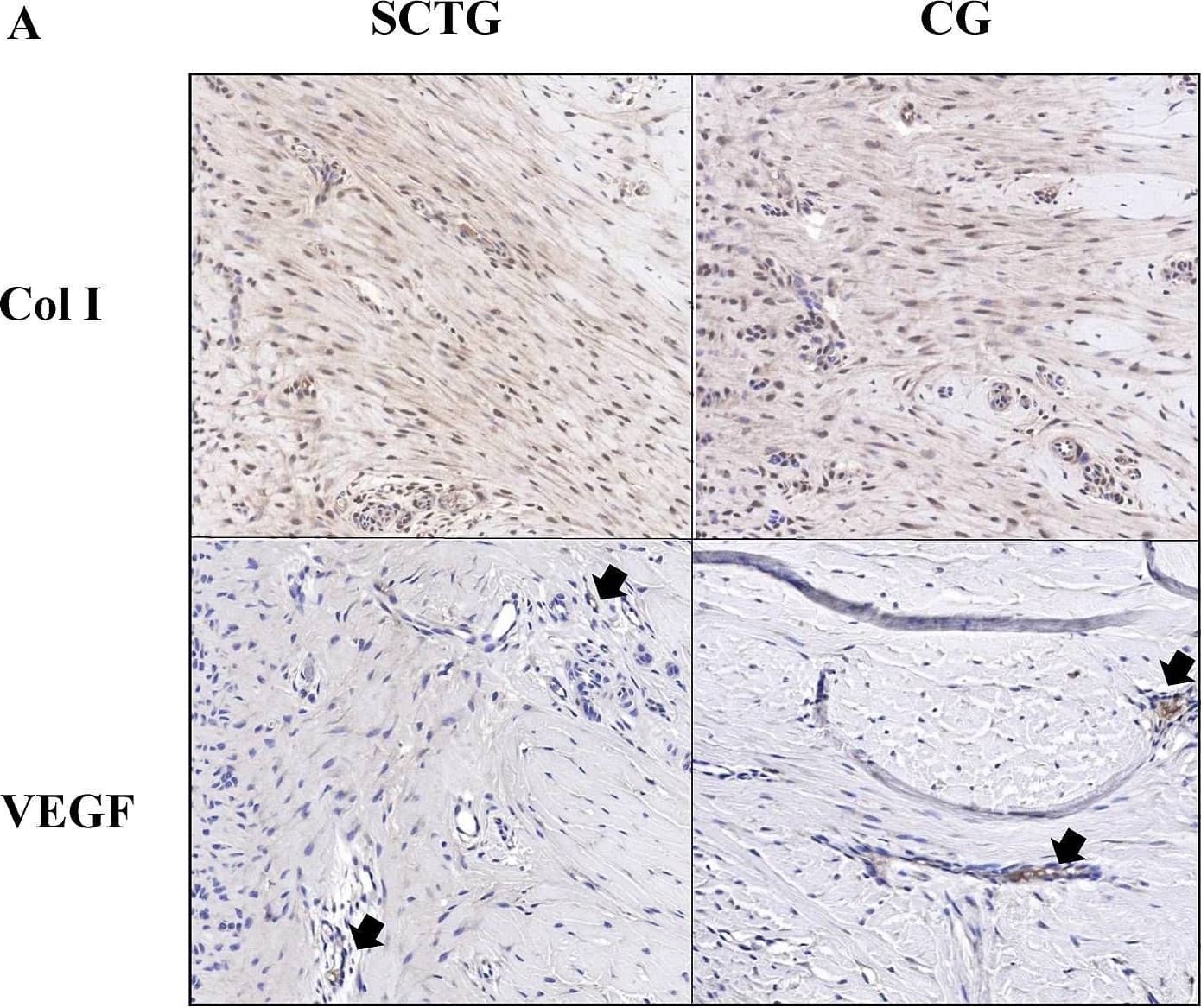 VEGF Antibody (VG1) - BSA Free