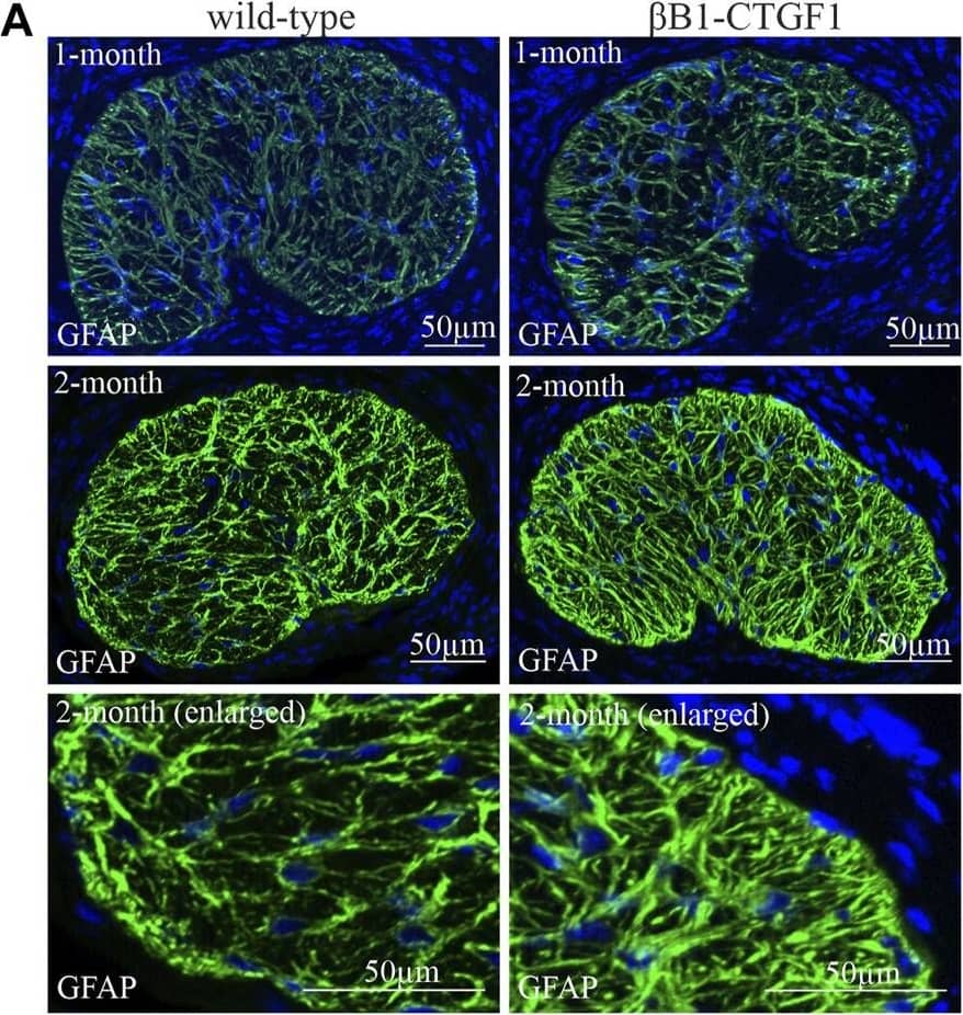 CTGF/CCN2 Antibody