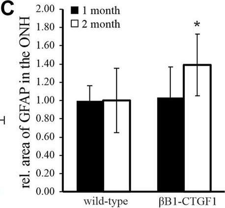 CTGF/CCN2 Antibody