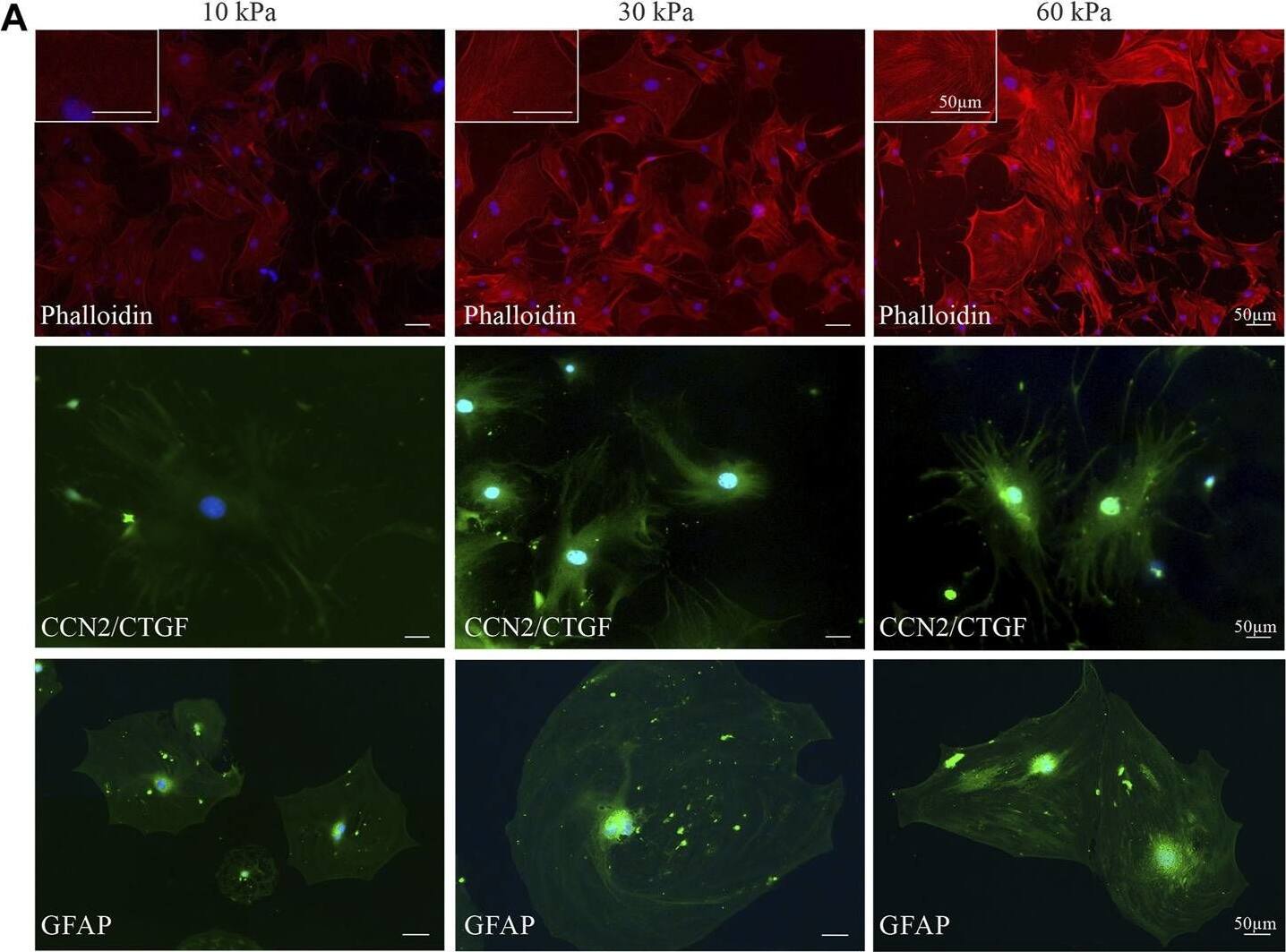 CTGF/CCN2 Antibody