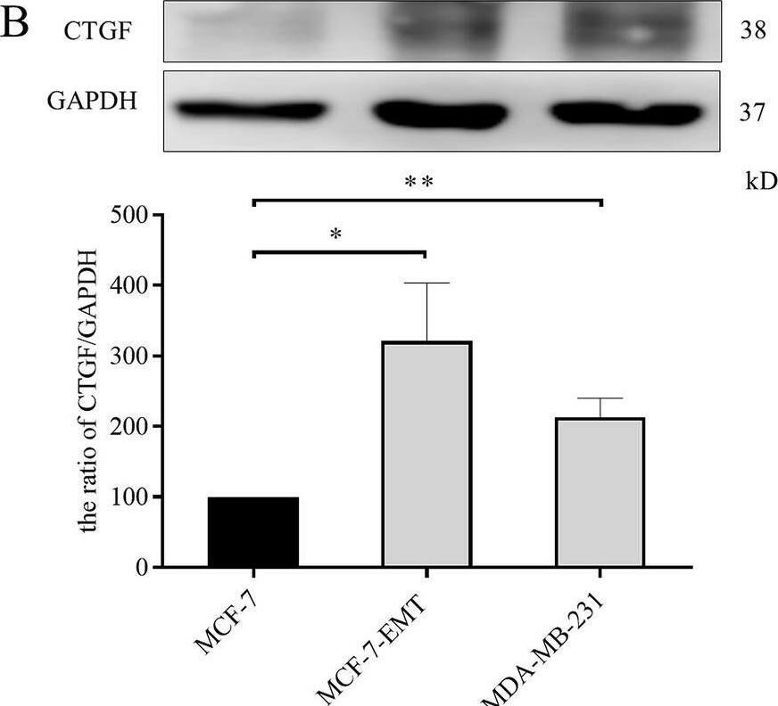 CTGF/CCN2 Antibody - BSA Free