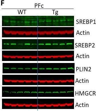 SREBP2 Antibody