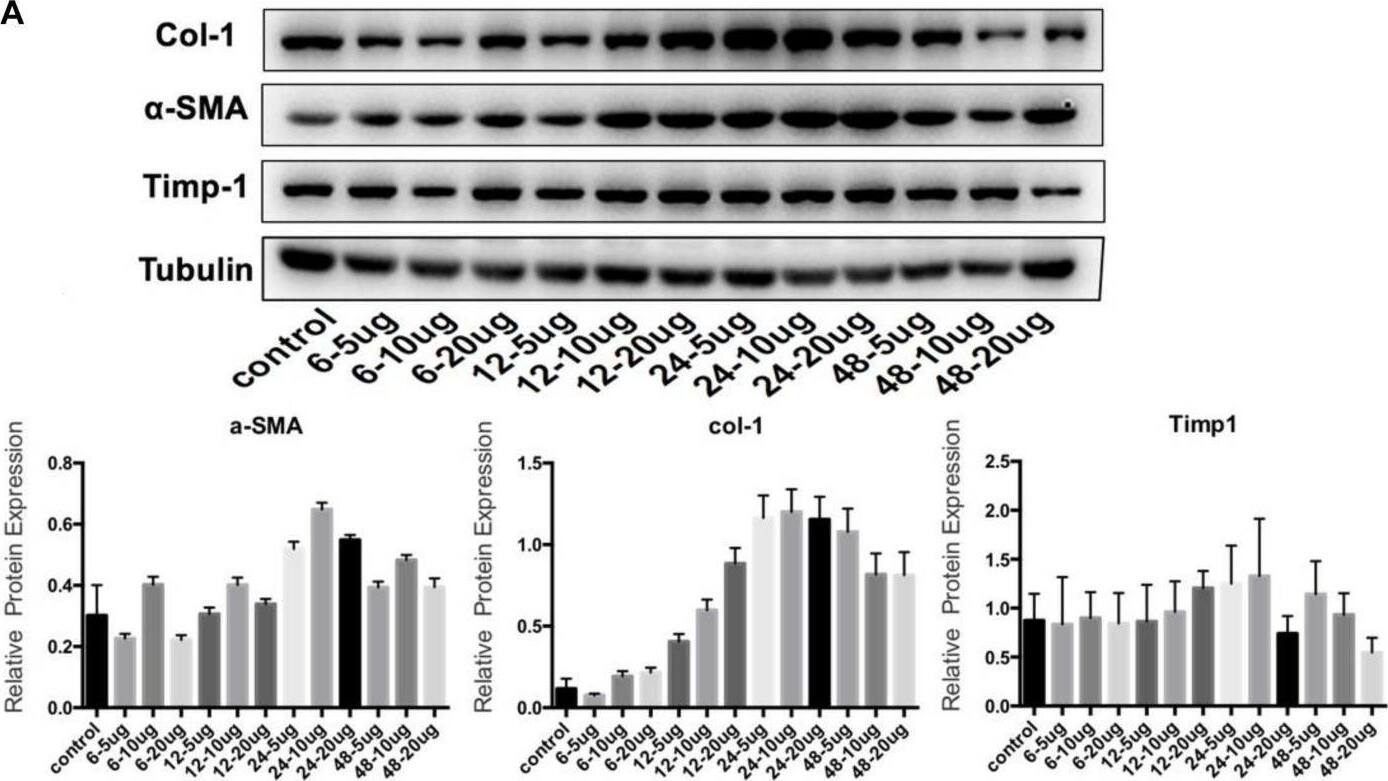 TIMP-1 Antibody (F31 P2 A5)
