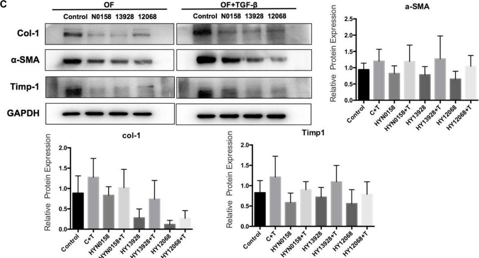 TIMP-1 Antibody (F31 P2 A5)