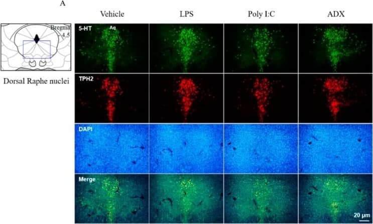 Tryptophan hydroxylase 2 Antibody - BSA Free