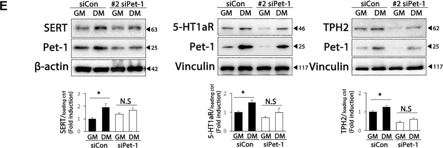 Tryptophan hydroxylase 2 Antibody - BSA Free