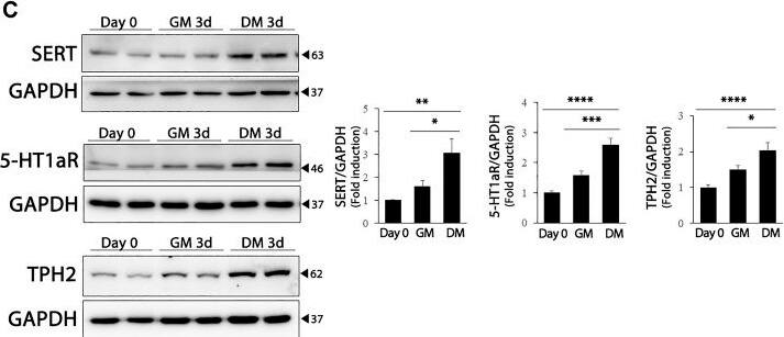 Tryptophan hydroxylase 2 Antibody - BSA Free