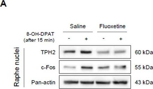 Tryptophan hydroxylase 2 Antibody - BSA Free