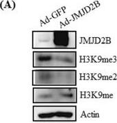 JMJD2B Antibody