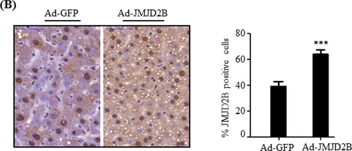 JMJD2B Antibody