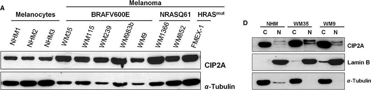CIP2A Antibody
