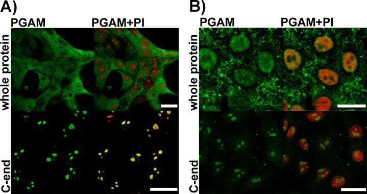 PGAM1/2/4 Antibody