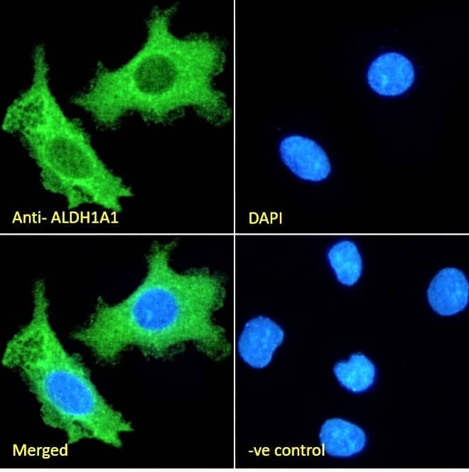 Aldehyde Dehydrogenase 1-A1/ALDH1A1 Antibody