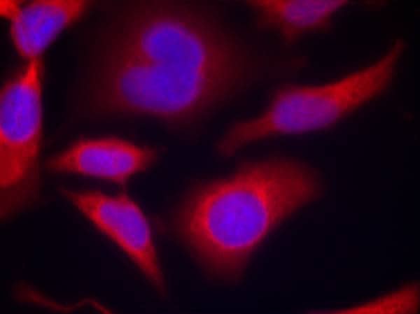 AMPK alpha 1 [p Ser496] Antibody