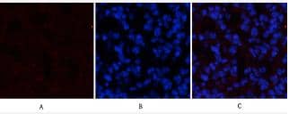 ATF4 [p Ser245] Antibody