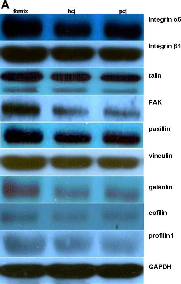 Cofilin Antibody - BSA Free