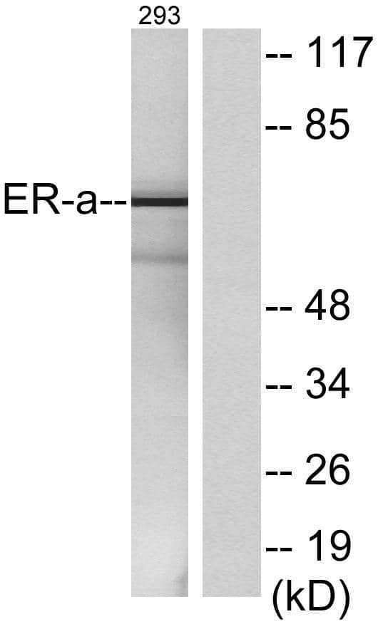 ER alpha/NR3A1 Antibody