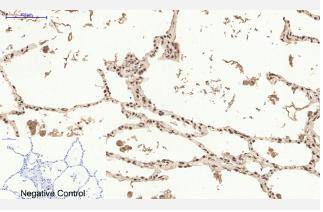 ER alpha/NR3A1 Antibody