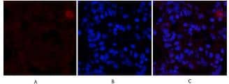 ER alpha/NR3A1 Antibody