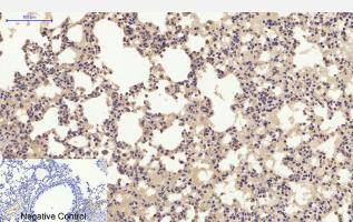 ER alpha/NR3A1 Antibody