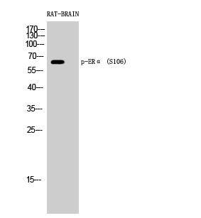 ER alpha/NR3A1 [p Ser106] Antibody