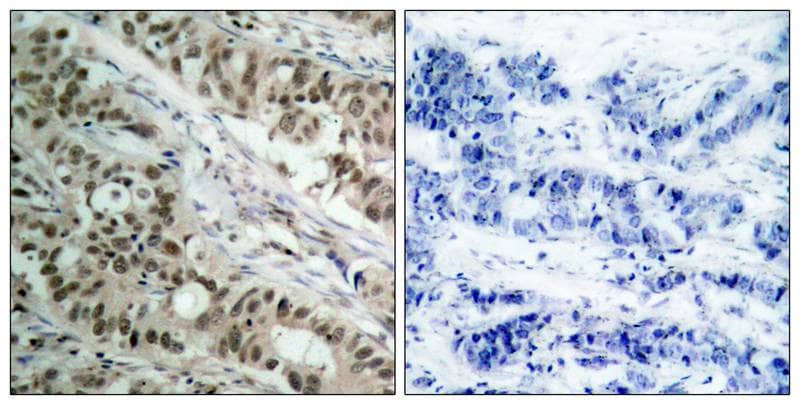 FoxO1/FKHR Antibody - BSA Free