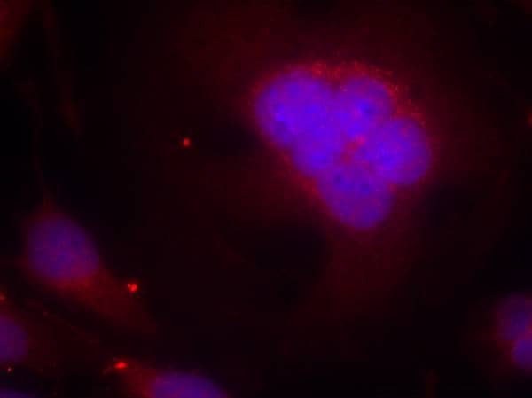 FoxO1/FKHR Antibody - BSA Free